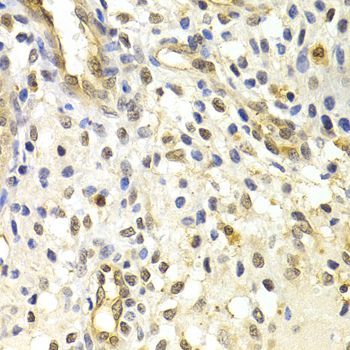 Immunohistochemistry - RAD50 Polyclonal Antibody (144-60013)