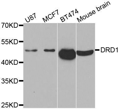 Western blot - DRD1 antibody (144-02893)
