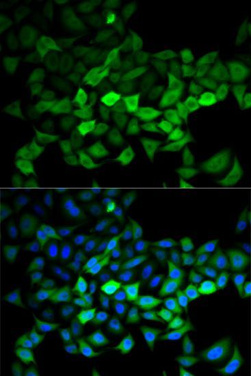 Immunofluorescence - UBE2C Polyclonal Antibody (144-05499)