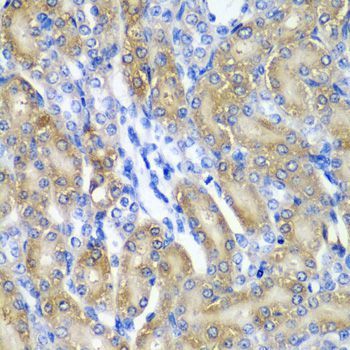 Immunohistochemistry - CRYAA antibody (144-05725)