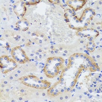 Immunohistochemistry - SYNPO antibody (144-08484)