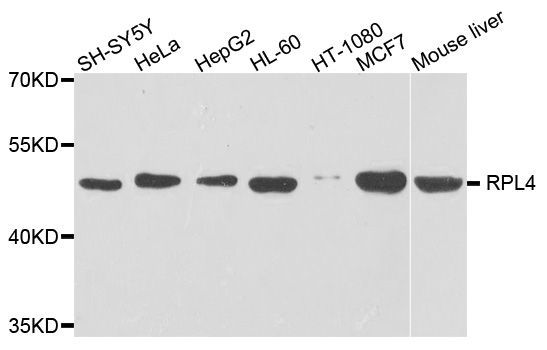 Western blot - RPL4 Polyclonal Antibody (144-05886)