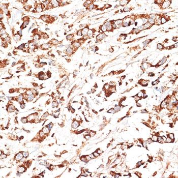 Immunohistochemistry - KLHL9 Polyclonal Antibody (144-010149)