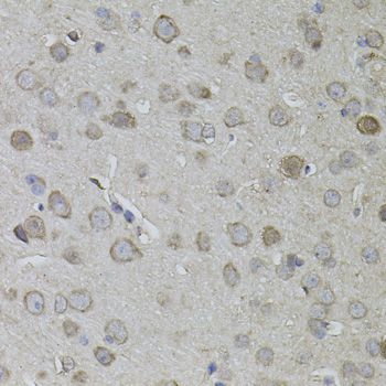 Immunohistochemistry - CKAP4 Polyclonal Antibody (144-07777)