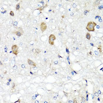 Immunohistochemistry - RBP2 antibody (144-06717)