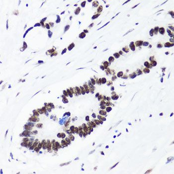 Immunohistochemistry - TriMethyl-Histone H3-K36 pAb (144-02366)
