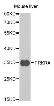 Western blot - PRKRA antibody (144-05417)