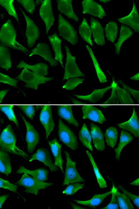 Immunofluorescence - BRCA1 Polyclonal Antibody (144-00212)