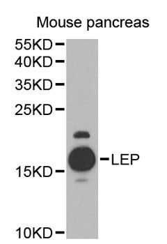 Western blot - LEP antibody (144-01300)