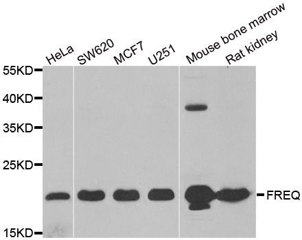 Western blot - NCS1 Polyclonal Antibody (144-06455)