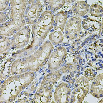 Immunohistochemistry - FDX1 antibody (144-09815)