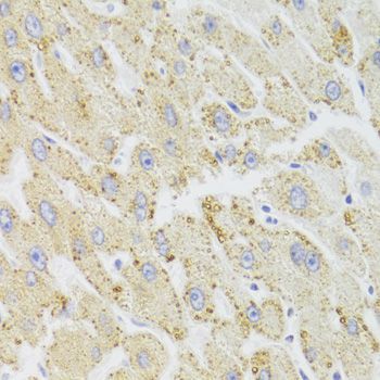 Immunohistochemistry - HSD17B13 Antibody (144-06256)