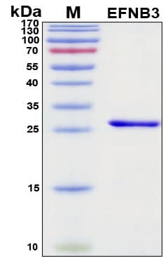 SDS-PAGE Image