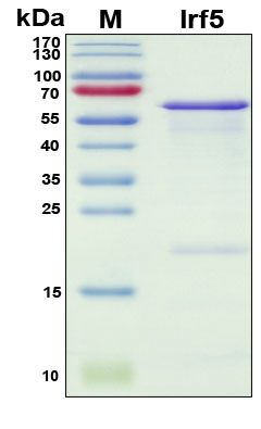 SDS-PAGE