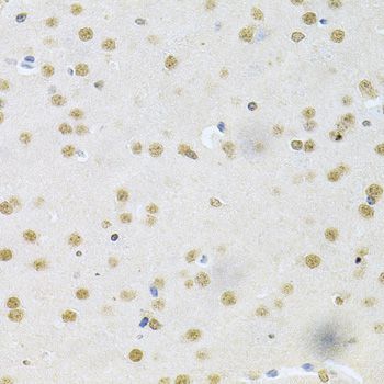 Immunohistochemistry - CBFB Antibody (144-05305)