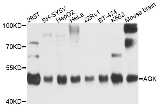 Western blot - AGK antibody (144-09976)