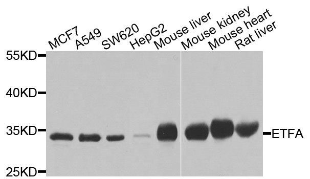 Western blot - ETFA antibody (144-07670)