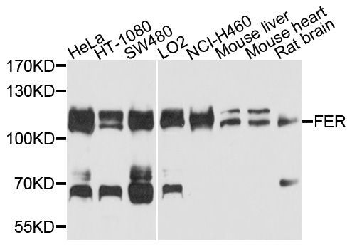Western blot - FER antibody (144-09687)