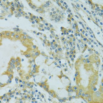 Immunohistochemistry - TJP2 Polyclonal Antibody (144-00594)