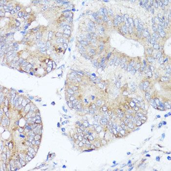 Immunohistochemistry - ATG5 Polyclonal Antibody (144-00203)