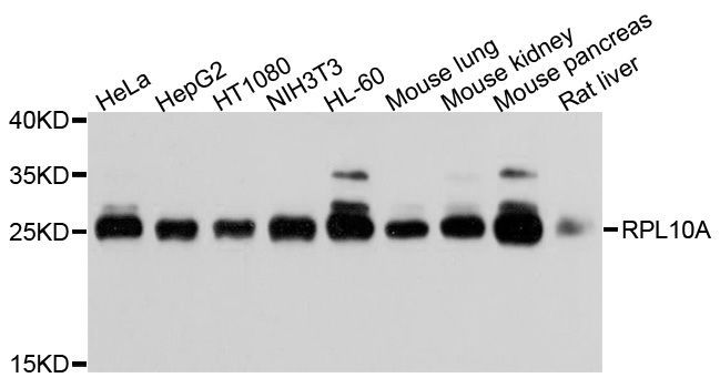 Western blot - RPL10A Polyclonal Antibody (144-05925)