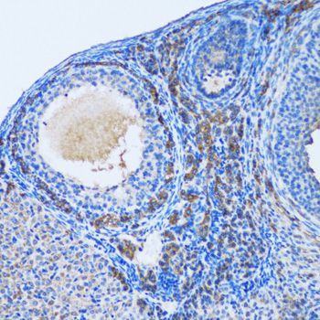Immunohistochemistry - OGDH Polyclonal Antibody (144-06391)