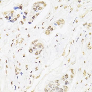 Immunohistochemistry - XRCC6 Polyclonal Antibody (144-00883)
