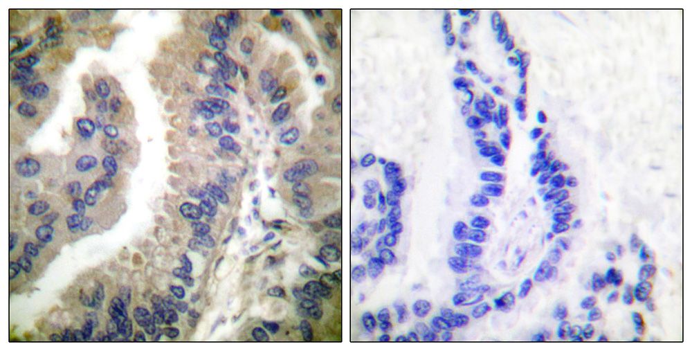 IHC