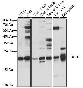 Western blot