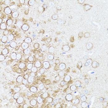 Immunohistochemistry - ARRB1 Polyclonal Antibody (144-00998)