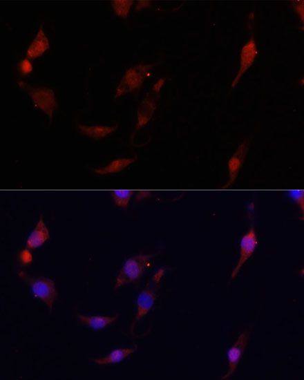 Immunofluorescence - [KO Validated] S100A4 Polyclonal Antibody (144-01631)