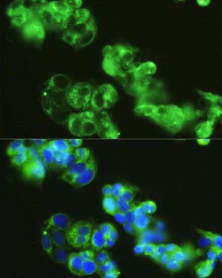 Immunofluorescence - GOLGA1 antibody (144-60750)