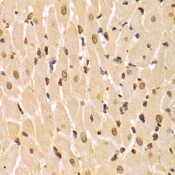 Immunohistochemistry - Lamin A/C Polyclonal Antibody (144-00249)