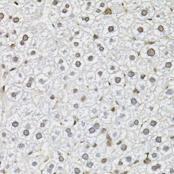 Immunohistochemistry - SMN2 Polyclonal Antibody (144-012519)