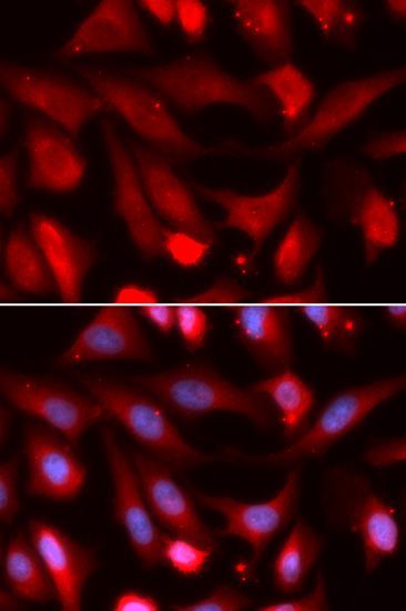 Immunofluorescence - SMAD4 antibody (144-05657)