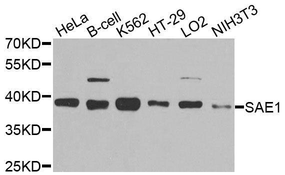 Western blot - SAE1 antibody (144-09960)