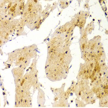 Immunohistochemistry - MVP Antibody (144-01980)