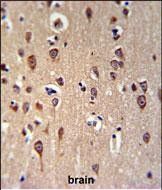 IHC-P
