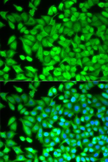 Immunofluorescence - FBP1 Polyclonal Antibody (144-05406)