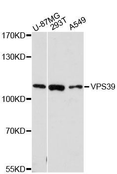 Western blot - VPS39 antibody (144-60178)