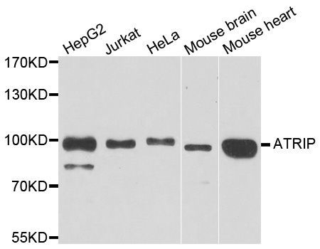 Western blot - ATRIP antibody (144-07139)