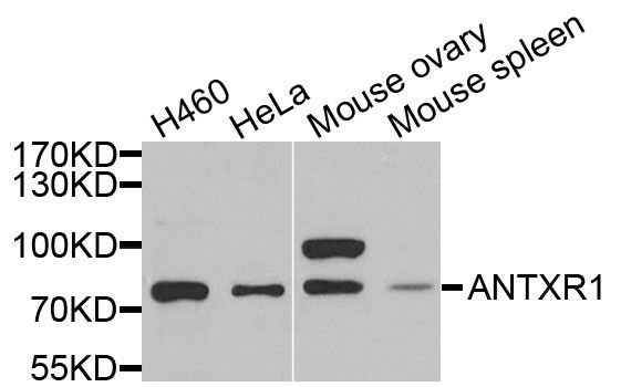 Western blot - ANTXR1 Polyclonal Antibody (144-06525)