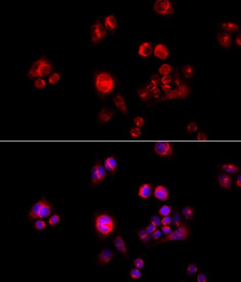 Immunofluorescence - GLUD2 antibody (144-06604)