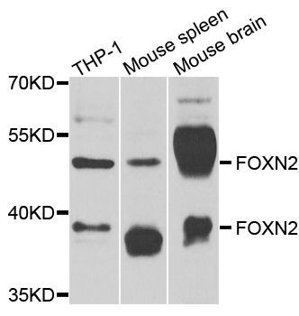 Western blot - FOXN2 antibody (144-07185)