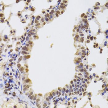Immunohistochemistry - AAAS Antibody (144-06427)