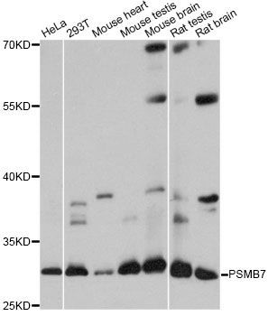 Western blot - PSMB7 antibody (144-60785)