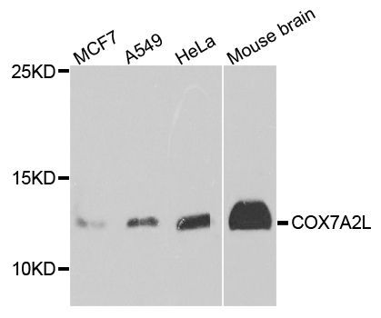 Western blot - COX7A2L antibody (144-08298)