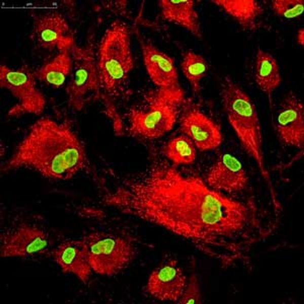 Fluorescent-labeled mesenchymal stem cells