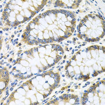 Immunohistochemistry - GNE Polyclonal Antibody (144-08570)