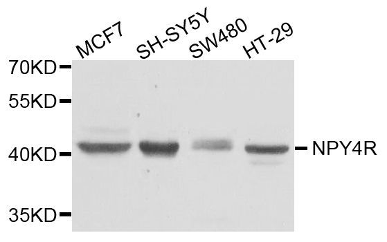 Western blot - NPY4R antibody (144-08143)